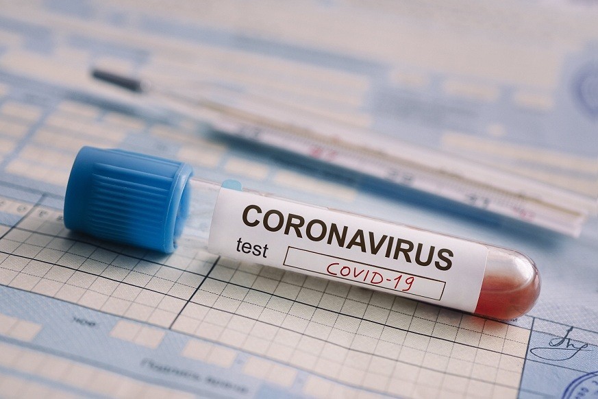 В Тульской области среднесуточный прирост заболеваемости коронавирусом составляет 0,85%.
