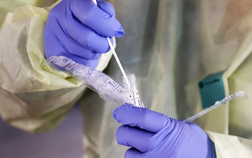 В Тульской области выявили 87 случаев коронавируса за минувшие сутки