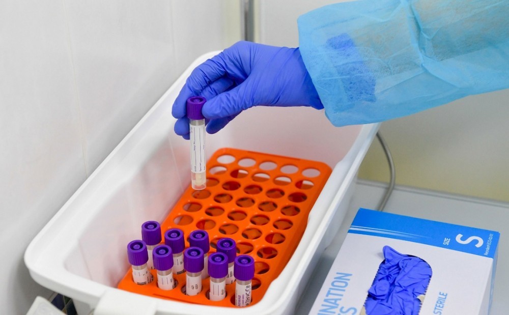 В Тульской области за сутки зафиксировали 1058 новых случаев заражения коронавирусом 